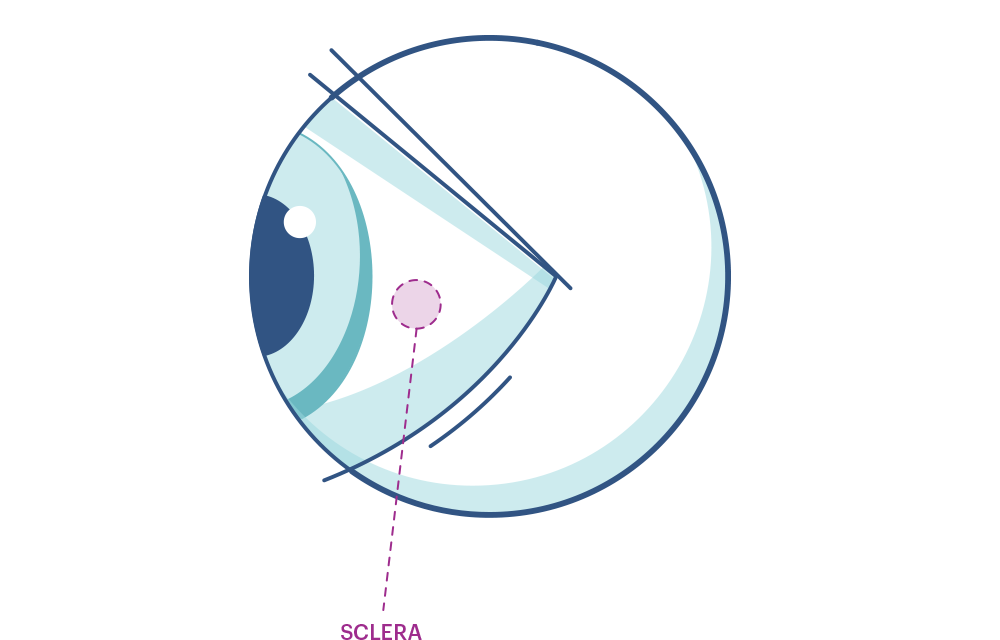 Eye illustration showing Sclera